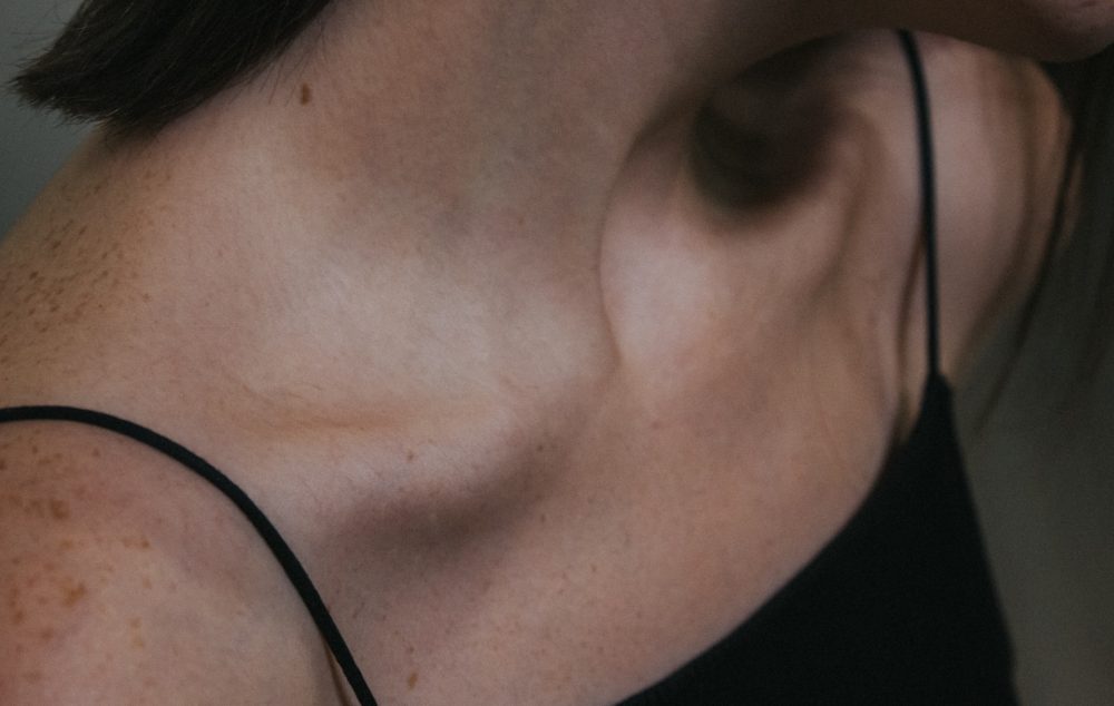 Wie man Nackenfalten vorbeugt: Was verursacht Falten am Hals und wie man sie stoppt